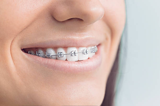 Best Teeth Whitening  in Fulton, IL